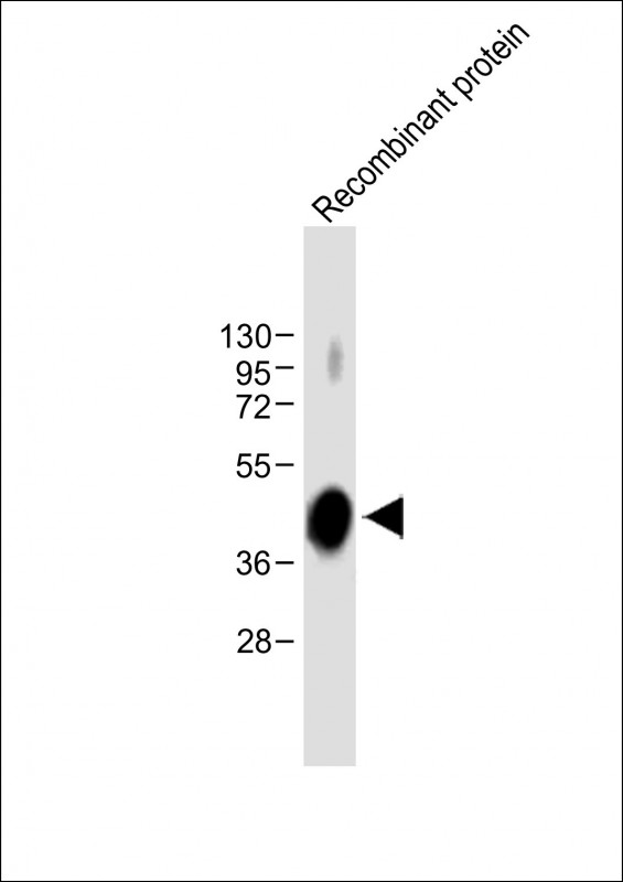 ADAMTS4 Antibody - Anti-ADAMTS4 Antibody at 1:8000 dilution + Recombinant protein Lysates/proteins at 20ng per lane. Secondary Goat Anti-mouse IgG, (H+L), Peroxidase conjugated at 1/10000 dilution. Predicted band size: 90 kDa Blocking/Dilution buffer: 5% NFDM/TBST.