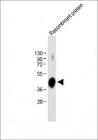 ADAMTS4 Antibody - Anti-ADAMTS4 Antibody at 1:8000 dilution + Recombinant protein Lysates/proteins at 20ng per lane. Secondary Goat Anti-mouse IgG, (H+L), Peroxidase conjugated at 1/10000 dilution. Predicted band size: 90 kDa Blocking/Dilution buffer: 5% NFDM/TBST.