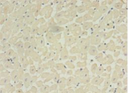 ADAMTS4 Antibody - Immunohistochemistry of paraffin-embedded human heart tissue using antibody at 1:100 dilution.  This image was taken for the unconjugated form of this product. Other forms have not been tested.