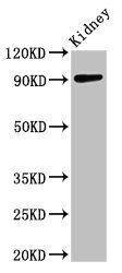 ADAMTS4 Antibody - Western Blot Positive WB detected in: mouse kidney tissue All lanes: ADAMTS4 antibody at 3.2µg/ml Secondary Goat polyclonal to rabbit IgG at 1/50000 dilution Predicted band size: 91 kDa Observed band size: 91 kDa
