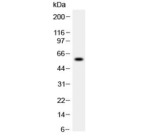 ADAMTS4 Antibody - Western blot testing of human recombinant ADAMTS4 partial protein (0.5ng/lane) with ADAMTS4 antibody at 0.5ug/ml. Predicted molecular weight of the full-length protein ~90 kDa.