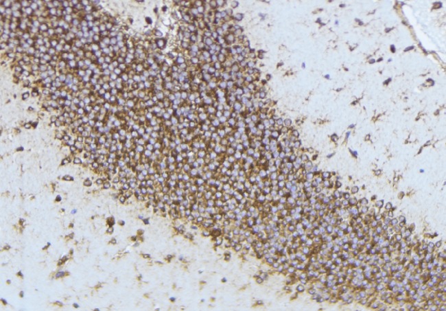 ADAMTS4 Antibody - 1:100 staining mouse brain tissue by IHC-P. The sample was formaldehyde fixed and a heat mediated antigen retrieval step in citrate buffer was performed. The sample was then blocked and incubated with the antibody for 1.5 hours at 22°C. An HRP conjugated goat anti-rabbit antibody was used as the secondary.
