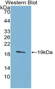 ADAMTS5 Antibody - Western blot of recombinant ADAMTS5.