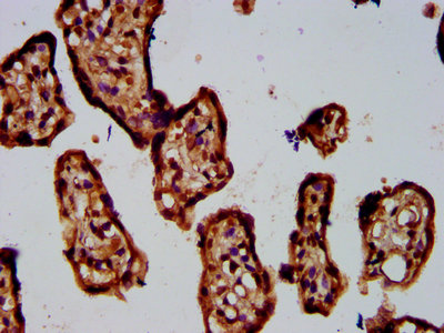 ADAMTS5 Antibody - Immunohistochemistry Dilution at 1:400 and staining in paraffin-embedded human placenta tissue performed on a Leica BondTM system. After dewaxing and hydration, antigen retrieval was mediated by high pressure in a citrate buffer (pH 6.0). Section was blocked with 10% normal Goat serum 30min at RT. Then primary antibody (1% BSA) was incubated at 4°C overnight. The primary is detected by a biotinylated Secondary antibody and visualized using an HRP conjugated SP system.