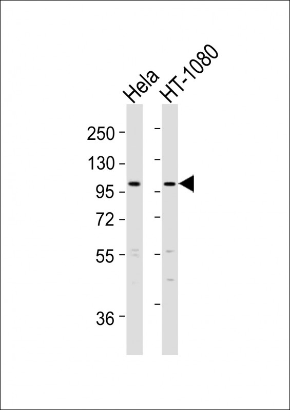 ADAMTS6 Antibody - All lanes : Anti-ADAMTS6 Antibody at 1:2000 dilution Lane 1: HeLa whole cell lysates Lane 2: HT-1080 whole cell lysates Lysates/proteins at 20 ug per lane. Secondary Goat Anti-Rabbit IgG, (H+L), Peroxidase conjugated at 1/10000 dilution Predicted band size : 125 kDa Blocking/Dilution buffer: 5% NFDM/TBST.