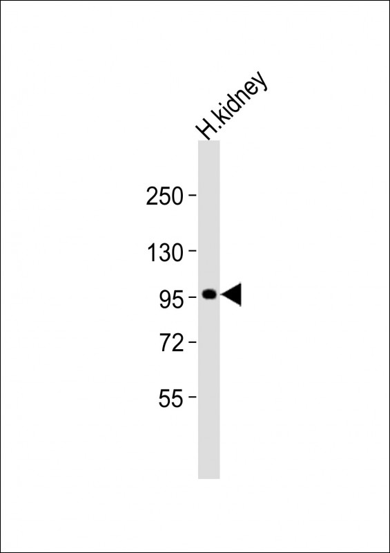 ADAMTS6 Antibody - Anti-ADAMTS6 Antibody at 1:2000 dilution + human kidney lysates Lysates/proteins at 20 ug per lane. Secondary Goat Anti-Rabbit IgG, (H+L), Peroxidase conjugated at 1/10000 dilution Predicted band size : 125 kDa Blocking/Dilution buffer: 5% NFDM/TBST.