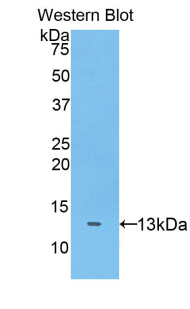 ADAMTS7 Antibody - Western blot of recombinant ADAMTS7.  This image was taken for the unconjugated form of this product. Other forms have not been tested.