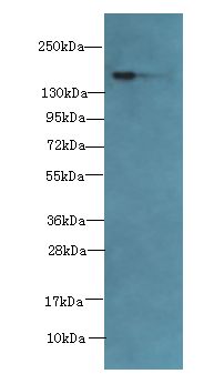 ADAMTS7 Antibody - Western blot. All lanes: ADAMTS7 antibody at 2 ug/ml+Mouse brain tissue. Secondary Goat polyclonal to rabbit at 1:10000 dilution. Predicted band size: 184 kDa. Observed band size: 184 kDa.
