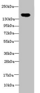 ADAMTS7 Antibody - Western blot All lanes: ADAMTS7 antibody at 2µg/ml + Mouse brain tissue Secondary Goat polyclonal to rabbit IgG at 1/10000 dilution Predicted band size: 184 kDa Observed band size: 184 kDa