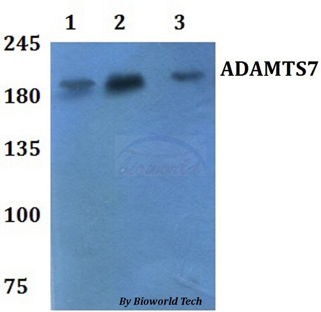 ADAMTS7 Antibody - Western blot of ADAMTS7 antibody at 1:500 dilution. Lane 1: HEK293T whole cell lysate. Lane 2: RAW264.7 whole cell lysate.