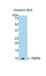ADAMTS8 Antibody - Western blot of recombinant ADAMTS8.  This image was taken for the unconjugated form of this product. Other forms have not been tested.