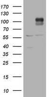 ADAMTS8 Antibody - HEK293T cells were transfected with the pCMV6-ENTRY control (Left lane) or pCMV6-ENTRY ADAMTS8 (Right lane) cDNA for 48 hrs and lysed. Equivalent amounts of cell lysates (5 ug per lane) were separated by SDS-PAGE and immunoblotted with anti-ADAMTS8.