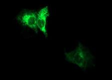 ADAMTS8 Antibody - Anti-ADAMTS8 mouse monoclonal antibody immunofluorescent staining of COS7 cells transiently transfected by pCMV6-ENTRY ADAMTS8.