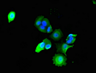 ADAMTS9 Antibody - Immunofluorescent analysis of MCF-7 cells using ADAMTS9 Antibody at dilution of 1:100 and Alexa Fluor 488-congugated AffiniPure Goat Anti-Rabbit IgG(H+L)