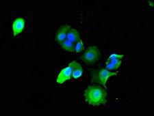 ADAMTS9 Antibody - Immunofluorescent analysis of MCF-7 cells using ADAMTS9 Antibody at dilution of 1:100 and Alexa Fluor 488-congugated AffiniPure Goat Anti-Rabbit IgG(H+L)
