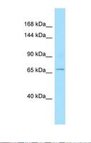 ADAMTSL1 Antibody - Western blot of Human 721_B. ADAMTSL1 antibody dilution 1.0 ug/ml.  This image was taken for the unconjugated form of this product. Other forms have not been tested.