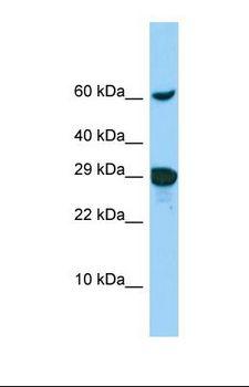 ADAMTSL1 Antibody - Western blot of COLO205. RPAP1 antibody dilution 1.0 ug/ml.  This image was taken for the unconjugated form of this product. Other forms have not been tested.