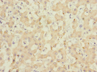 ADAMTSL4 Antibody - Immunohistochemistry of paraffin-embedded human liver tissue at dilution 1:100