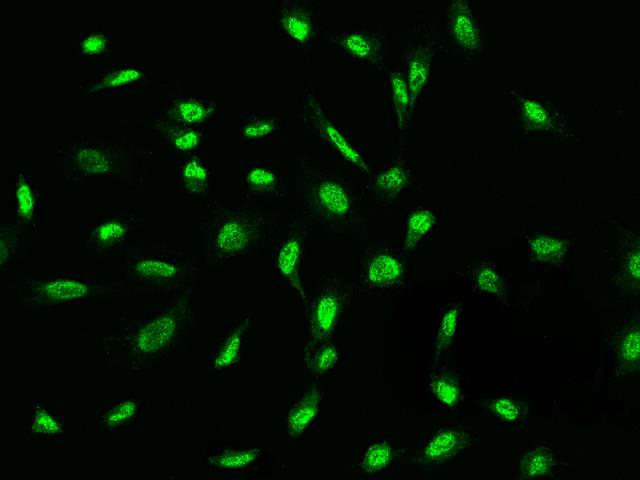 ADAMTSL4 Antibody - Immunofluorescence staining of ADAMTSL4 in HeLa cells. Cells were fixed with 4% PFA, permeabilzed with 0.3% Triton X-100 in PBS, blocked with 10% serum, and incubated with rabbit anti-Human ADAMTSL4 polyclonal antibody (dilution ratio 1:200) at 4°C overnight. Then cells were stained with the Alexa Fluor 488-conjugated Goat Anti-rabbit IgG secondary antibody (green). Positive staining was localized to Nucleus.