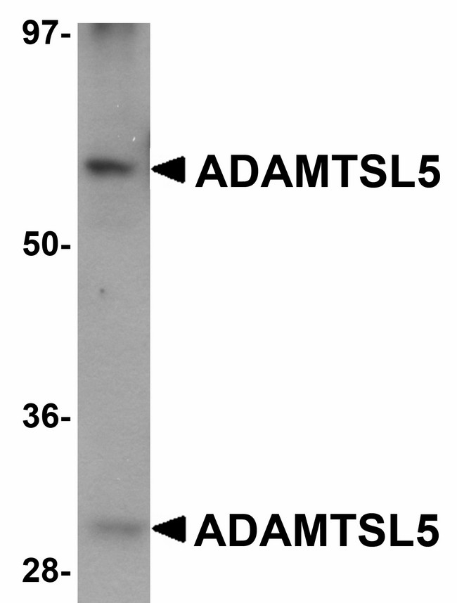 ADAMTSL5 Antibody - Western blot of ADAMTSL5 in human skeletal muscle tissue lysate with ADAMTSL5 antibody at 1 ug/ml.