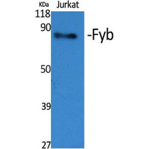 ADAP / FYB Antibody - Western blot of Fyb antibody