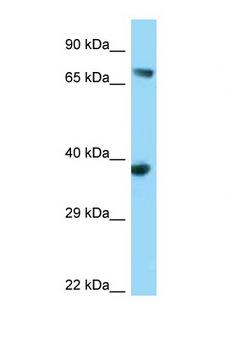 ADAP / FYB Antibody - FYB antibody Western blot of 293T Cell lysate. Antibody concentration 1 ug/ml.  This image was taken for the unconjugated form of this product. Other forms have not been tested.