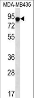 ADAP / FYB Antibody - FYB Antibody western blot of MDA-MB435 cell line lysates (35 ug/lane). The FYB antibody detected the FYB protein (arrow).