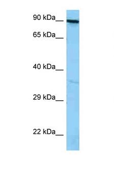ADAP / FYB Antibody - FYB antibody Western blot of A549 Cell lysate. Antibody concentration 1 ug/ml.  This image was taken for the unconjugated form of this product. Other forms have not been tested.