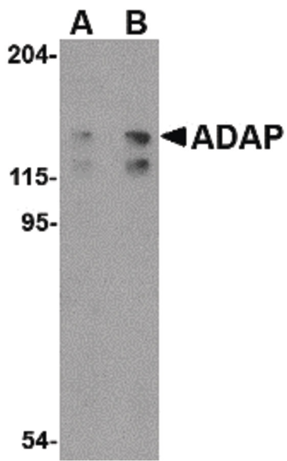 ADAP / FYB Antibody - Western blot of ADAP in K562 cell lysate with ADAP antibody at (A) 0.5 and (B) 1 ug/ml.