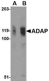 ADAP / FYB Antibody - Western blot of ADAP in K562 cell lysate with ADAP antibody at (A) 0.5 and (B) 1 ug/ml.
