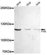 ADAP / FYB Antibody - Western blot detection of FYB in 10, 20 and 30ug Jurkat cell lysate using FYB mouse monoclonal antibody (1:500 dilution). Predicted band size: 120KDa. Observed band size:120KDa.