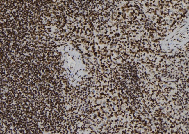 ADAP / FYB Antibody - 1:100 staining mouse spleen tissue by IHC-P. The sample was formaldehyde fixed and a heat mediated antigen retrieval step in citrate buffer was performed. The sample was then blocked and incubated with the antibody for 1.5 hours at 22°C. An HRP conjugated goat anti-rabbit antibody was used as the secondary.