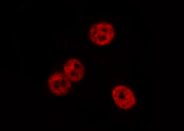 ADAP / FYB Antibody - Staining COLO cells by IF/ICC. The samples were fixed with PFA and permeabilized in 0.1% Triton X-100, then blocked in 10% serum for 45 min at 25°C. The primary antibody was diluted at 1:200 and incubated with the sample for 1 hour at 37°C. An Alexa Fluor 594 conjugated goat anti-rabbit IgG (H+L) antibody, diluted at 1/600, was used as secondary antibody.