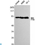 ADAP / FYB Antibody - Western Blot (WB) analysis using Fyb Monoclonal Antibody against Jurkat, K562, TF-1 cell lysate.