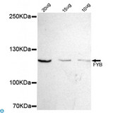 ADAP / FYB Antibody - Western blot detection of FYB in 10, 20 and 30ug Jurkat cell lysate using FYB mouse mAb (1:500 diluted). Predicted band size: 120KDa. Observed band size: 120KDa.