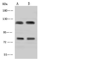 ADAP / FYB Antibody - Anti-FYB rabbit polyclonal antibody at 1:500 dilution. Lane A: TF-1 Whole Cell Lysate. Lane B: Jurkat Whole Cell Lysate. Lysates/proteins at 30 ug per lane. Secondary: Goat Anti-Rabbit IgG (H+L)/HRP at 1/10000 dilution. Developed using the ECL technique. Performed under reducing conditions. Predicted band size: 85 kDa. Observed band size: 120 kDa. (We are unsure as to the identity of these extra bands.)