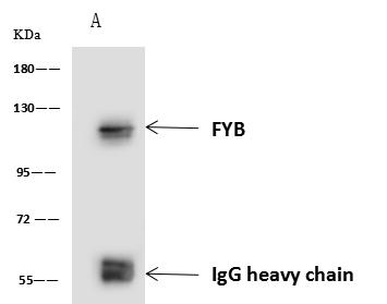 ADAP / FYB Antibody - FYB was immunoprecipitated using: Lane A: 0.5 mg Jurkat Whole Cell Lysate. 4 uL anti-FYB rabbit polyclonal antibody and 60 ug of Immunomagnetic beads Protein A/G. Primary antibody: Anti-FYB rabbit polyclonal antibody, at 1:100 dilution. Secondary antibody: Goat Anti-Rabbit IgG (H+L)/HRP at 1/10000 dilution. Developed using the ECL technique. Performed under reducing conditions. Predicted band size: 85 kDa. Observed band size: 120 kDa.