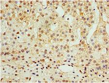 ADAP1 / CENTA1 Antibody - Immunohistochemistry of paraffin-embedded human adrenal gland using antibody at 1:100 dilution.