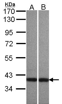 ADAP1 / CENTA1 Antibody - Sample (30 ug of whole cell lysate). A: A431 , B: HeLaS3. 7.5% SDS PAGE. CENTA1 / ADAP1 antibody diluted at 1:500