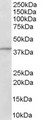 ADAP1 / CENTA1 Antibody - Antibody (1 ug/ml) staining of Human Brain lysate (35 ug protein in RIPA buffer). Primary incubation was 1 hour. Detected by chemiluminescence.
