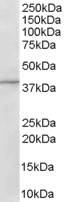 ADAP1 / CENTA1 Antibody - Antibody (1 ug/ml) staining of Human Brain lysate (35 ug protein in RIPA buffer). Primary incubation was 1 hour. Detected by chemiluminescence.