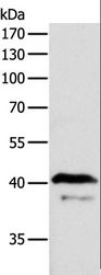 ADAP1 / CENTA1 Antibody - Western blot analysis of Mouse brain tissue, using ADAP1 Polyclonal Antibody at dilution of 1:500.