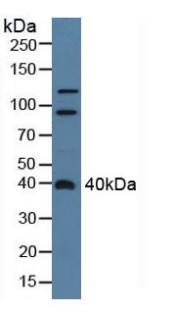 ADAP2 / CENTA2 Antibody - Western Blot; Sample: Rat Serum.