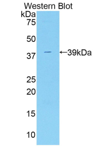 ADAP2 / CENTA2 Antibody - Western blot of recombinant ADAP2 / CENTA2.  This image was taken for the unconjugated form of this product. Other forms have not been tested.