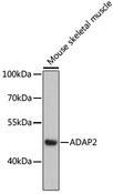 ADAP2 / CENTA2 Antibody - Western blot analysis of extracts of mouse skeletal muscle using ADAP2 Polyclonal Antibody at dilution of 1:3000.