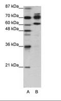 ADAR2 / ADARB1 Antibody - A: Marker, B: HepG2 Cell Lysate.  This image was taken for the unconjugated form of this product. Other forms have not been tested.