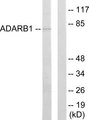 ADAR2 / ADARB1 Antibody - Western blot analysis of lysates from HepG2 cells, using ADARB1 Antibody. The lane on the right is blocked with the synthesized peptide.