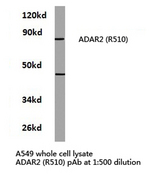 ADAR2 / ADARB1 Antibody - Western blot of ADAR2 (R510) pAb in extracts from A549 cells.