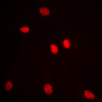 ADAR2 / ADARB1 Antibody - Immunofluorescent analysis of ADAR2 staining in MCF7 cells. Formalin-fixed cells were permeabilized with 0.1% Triton X-100 in TBS for 5-10 minutes and blocked with 3% BSA-PBS for 30 minutes at room temperature. Cells were probed with the primary antibody in 3% BSA-PBS and incubated overnight at 4 C in a humidified chamber. Cells were washed with PBST and incubated with a DyLight 594-conjugated secondary antibody (red) in PBS at room temperature in the dark. DAPI was used to stain the cell nuclei (blue).