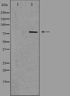 ADAR2 / ADARB1 Antibody - Western blot analysis of extracts of HepG2 cells using ADARB1 antibody. The lane on the left is treated with the antigen-specific peptide.